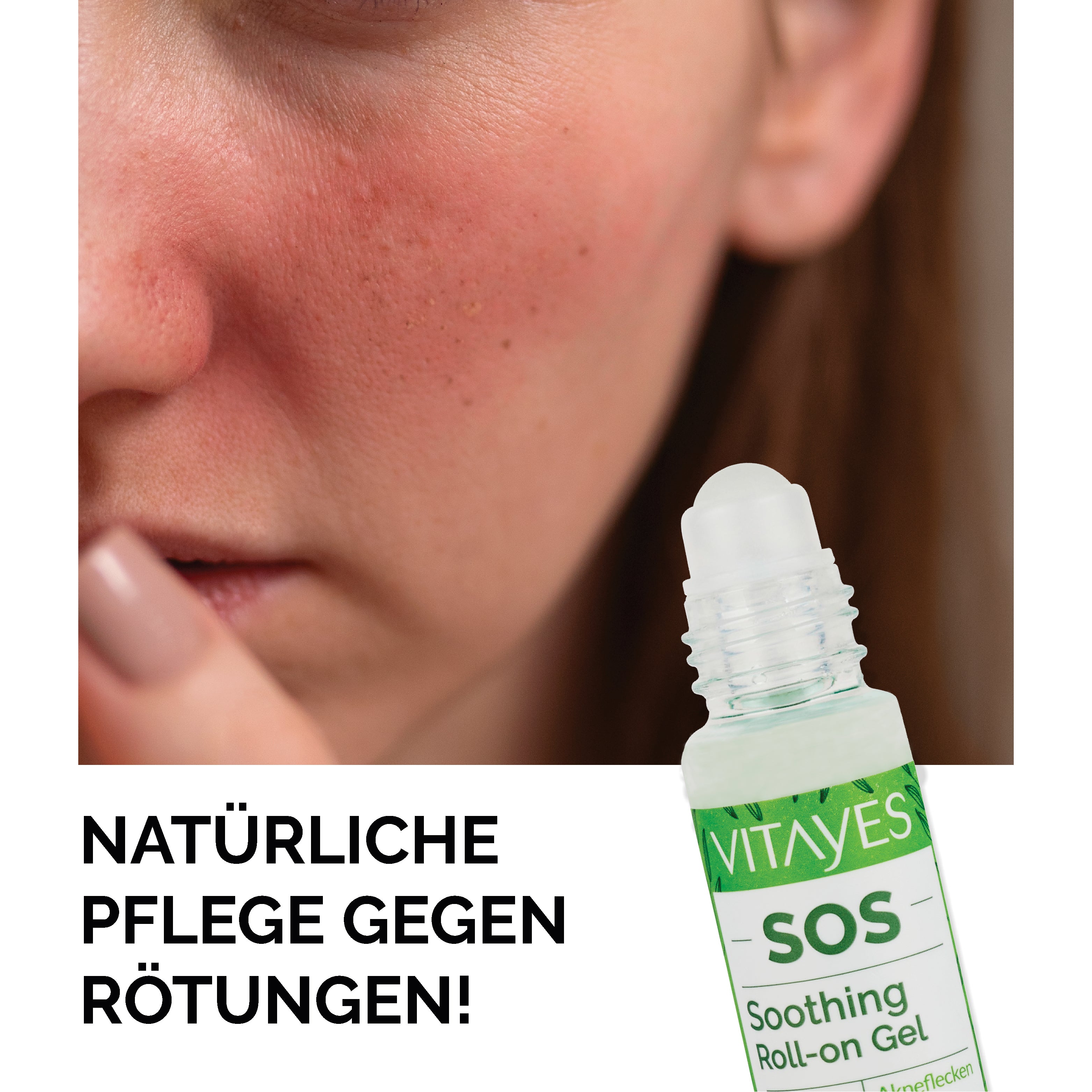 SOS Teebaumöl Roll-On von Vitayes, 10 ml, zur schnellen Linderungen bei Pickeln, Rötungen und Hautreizungen, praktische Anwendung.