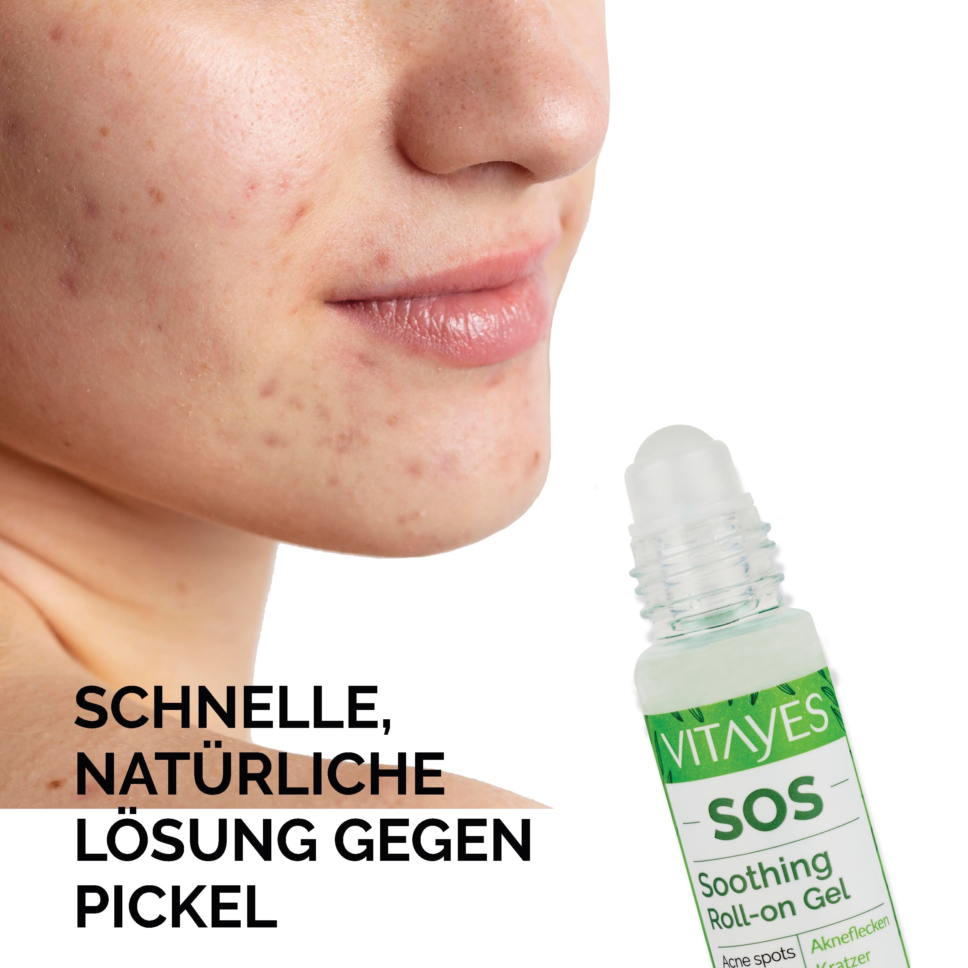 SOS Teebaumöl Roll-On von Vitayes, 10 ml, bei Pickeln, Rötungen und Hautreizungen, praktischer Antiseptik-Roll-On.
