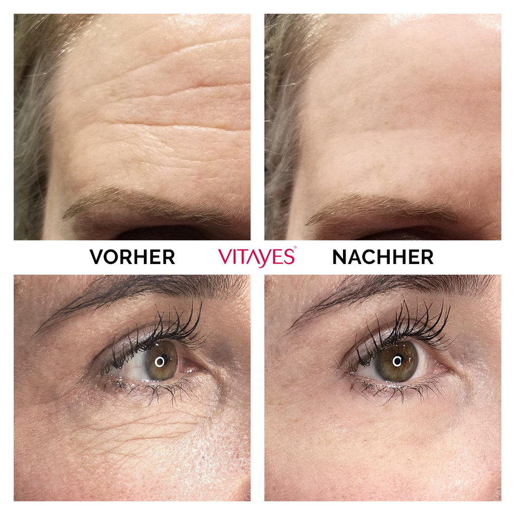 Instant Ageback™ - Lifting - Creme gegen Tränensäcke und Falten - "Beauty by Fifi"