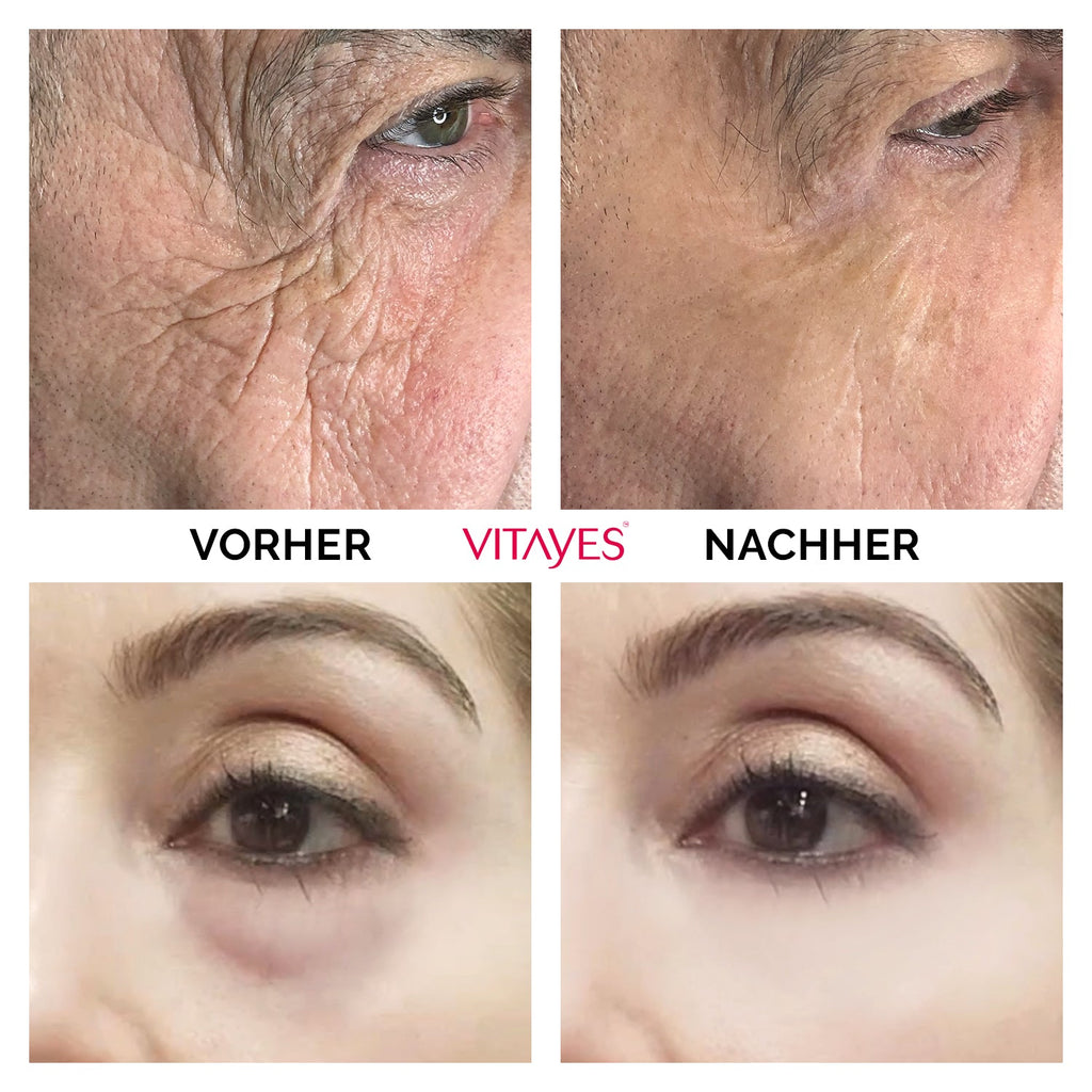Instant Ageback™ - Lifting - Creme gegen Tränensäcke und Falten - "Beauty by Fifi"
