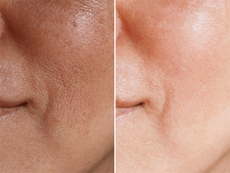 Perfector Vitamin C 10% Serum – Mit Hyaluron 30 ml - "Beauty by Fifi"