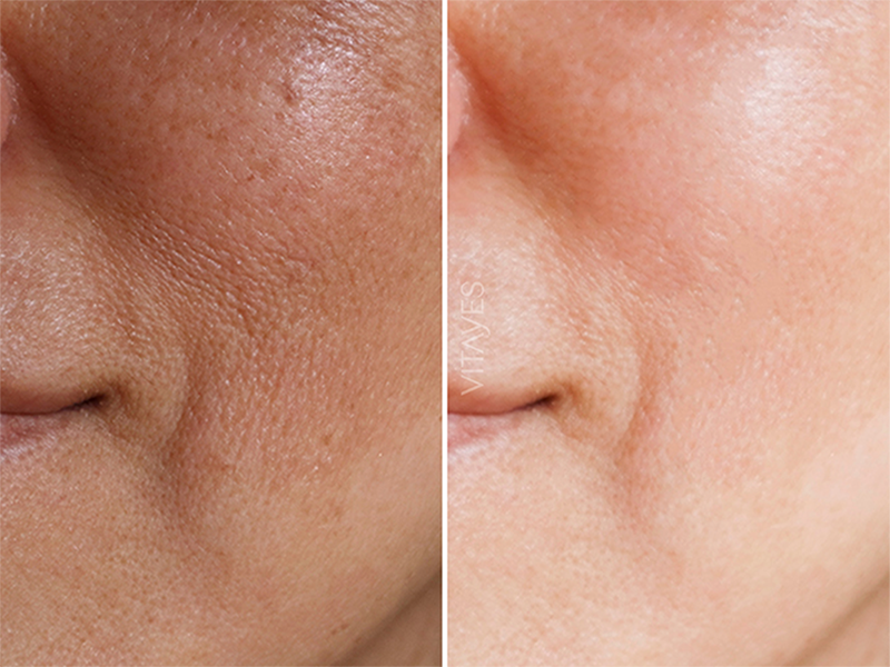 Vitayes Perfector Vitamin C 10% Serum mit Hyaluron, 30 ml Flasche, Nahaufnahme des Serums in einer dunklen Glasflasche